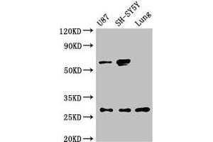 Western Blot Positive WB detected in: U87 whole cell lysate, SH-SY5Y whole cell lysate, Rat lung tissue All lanes: NEUROG2 antibody at 3 μg/mL Secondary Goat polyclonal to rabbit IgG at 1/50000 dilution Predicted band size: 29 kDa Observed band size: 29, 60 kDa (Neurogenin 2 anticorps  (AA 194-262))