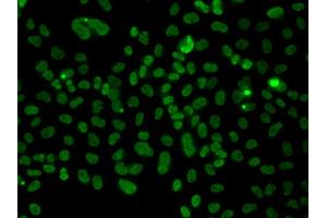Immunofluorescence analysis of A549 cells using PLCXD2 antibody. (PLCXD2 anticorps)