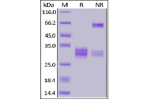 Human CD8A&CD8B Heterodimer Protein, His Tag&Tag Free on  under reducing (R) and ing (NR) conditions.