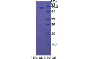 SDS-PAGE analysis of Rat Lipase, Hepatic Protein. (LIPC Protéine)