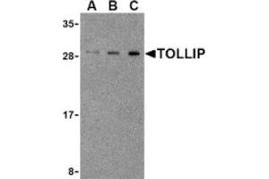 Image no. 1 for anti-Toll Interacting Protein (TOLLIP) (Middle Region) antibody (ABIN265154) (TOLLIP anticorps  (Middle Region))