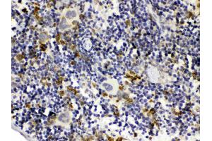 GC1q R was detected in paraffin-embedded sections of mouse spleen tissues using rabbit anti- GC1q R Antigen Affinity purified polyclonal antibody (Catalog # ) at 1 µg/mL.