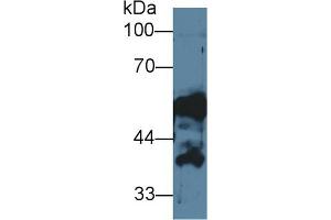 Detection of CK14 in Human Saliva using Polyclonal Antibody to Cytokeratin 14 (CK14)
