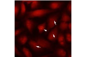 Immunofluorescence (IF) image for anti-Tubulin, beta 2B (TUBB2B) antibody (ABIN567611)