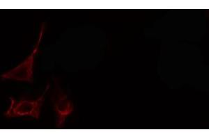 ABIN6266973 staining Hela cells by IF/ICC.