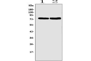 Western blot analysis of SLC5A2 using anti-SLC5A2 antibody (ABIN6719506).