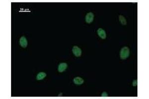 Immunostaining analysis in HeLa cells. (NRF2 anticorps)