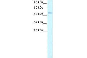 WB Suggested Anti-CCR8 Antibody Titration:  2. (CCR8 anticorps  (Middle Region))
