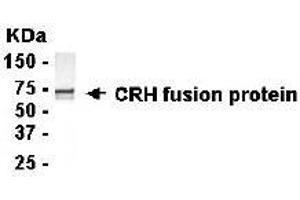 Image no. 1 for anti-Corticotropin Releasing Hormone (CRH) (AA 27-196) antibody (ABIN294738) (CRH anticorps  (AA 27-196))