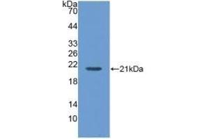 Detection of Recombinant MGA, Human using Polyclonal Antibody to Maltase-glucoamylase (MGAM)