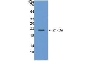 Detection of Recombinant MGA, Human using Polyclonal Antibody to Maltase-glucoamylase (MGAM) (Maltase-Glucoamylase (MGAM) (AA 213-392) anticorps)