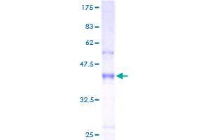 Image no. 1 for Hepatitis A Virus Cellular Receptor 2 (TIM 3) (AA 1-142) protein (GST tag) (ABIN1306377)