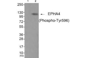 Western blot analysis of extracts from JK cells (Lane 2), using EPHA4 (Phospho-Tyr596) Antibody. (EPH Receptor A4 anticorps  (pTyr596))