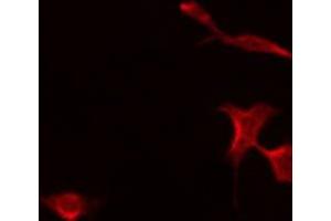 ABIN6275476 staining A549 by IF/ICC.