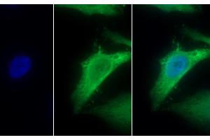 Detection of MTNR1A in Human HepG2 cell using Polyclonal Antibody to Melatonin Receptor 1A (MTNR1A)