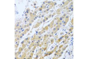 Immunohistochemistry of paraffin-embedded human liver using STC1 antibody (ABIN5975425) at dilution of 1/100 (40x lens). (Stanniocalcin 1 anticorps)