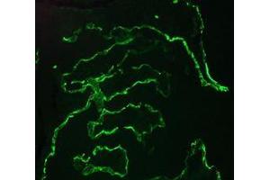 Image no. 1 for anti-Keratin 10 (KRT10) antibody (ABIN959490)