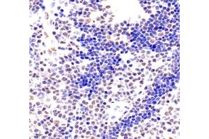 Immunohistochemistry of paraffin embedded rat thymus using ZC3H11A (ABIN7076255) at dilution of 1: 6000 (500x lens)