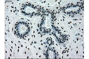 Immunohistochemical staining of paraffin-embedded breast tissue using anti-SILV mouse monoclonal antibody. (Melanoma gp100 anticorps)