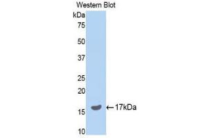 Western Blotting (WB) image for anti-serpin Peptidase Inhibitor, Clade A (Alpha-1 Antiproteinase, Antitrypsin), Member 6 (SERPINA6) (AA 267-390) antibody (ABIN1858271)