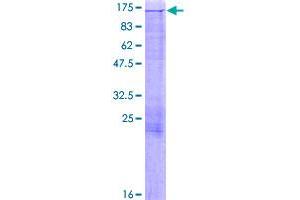 Image no. 1 for Microtubule Associated Monoxygenase, Calponin and LIM Domain Containing 1 (MICAL1) (AA 1-981) protein (GST tag) (ABIN1310909)