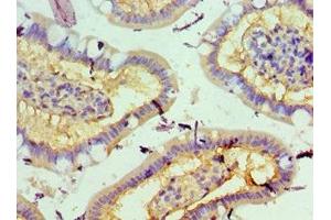 Immunohistochemistry of paraffin-embedded human small intestine tissue using ABIN7168990 at dilution of 1:100