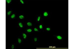 Image no. 2 for anti-Nucleophosmin (Nucleolar phosphoprotein B23, Numatrin) (NPM1) (AA 1-295) antibody (ABIN598843) (NPM1 anticorps  (AA 1-295))
