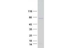 Validation with Western Blot