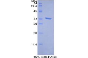 SDS-PAGE analysis of Human Metallothionein 1E Protein. (MT1E Protéine)