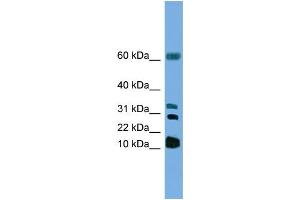 WB Suggested Anti-LTC4S Antibody Titration: 1. (LTC4S anticorps  (N-Term))
