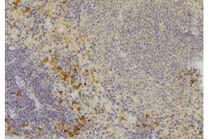 ABIN6272568 at 1/100 staining Human lymph node tissue by IHC-P. (CCBE1 anticorps  (Internal Region))