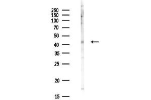 anti-Protein-L-Isoaspartate (D-Aspartate) O-Methyltransferase Domain Containing 1 (PCMTD1) antibody