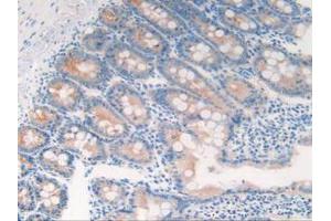 IHC-P analysis of Rat Intestine Tissue, with DAB staining. (Cytokeratin 18 anticorps  (AA 72-380))