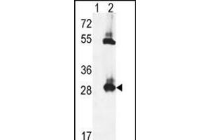 Western blot analysis of TPK1 (arrow) using rabbit polyclonal TPK1 Antibody (N-term) (ABIN653087 and ABIN2842683). (TPK1 anticorps  (N-Term))