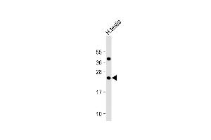 Anti-FA Antibody (C-Term) at 1:2000 dilution + Human testis lysate Lysates/proteins at 20 μg per lane. (FAM3A anticorps  (AA 201-230))