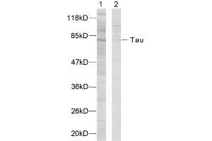 Western Blotting (WB) image for anti-tau Protein (Ser235) antibody (ABIN1848162) (tau anticorps  (Ser235))
