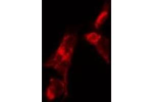 ABIN6268790 staining HUVEC by IF/ICC. (FSHR anticorps  (Internal Region))