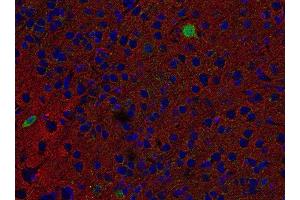 Indirect immunostaining of PFA fixed paraffin embedded mouse brain section with anti-SV2 B (dilution 1 : 500; red) and chicken anti-Parvalbumin (, dilution 1 : 500; green). (SV2B anticorps  (AA 2-17))