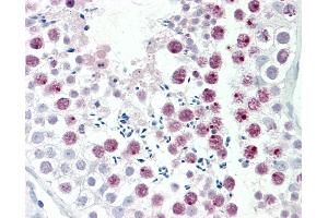 Human, Testis: Formalin-Fixed Paraffin-Embedded (FFPE).