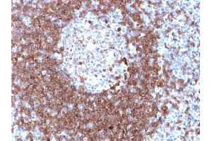 Formalin-fixed, paraffin-embedded human Tonsil stained with CD79a Rabbit Polyclonal Antibody. (CD79a anticorps  (AA 202-216))