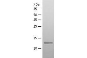 Western Blotting (WB) image for SET Domain Containing (Lysine Methyltransferase) 8 (SETD8) (AA 195-352) protein (His-IF2DI Tag) (ABIN7125068)