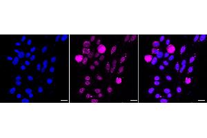 Immunocytochemical staining of HepG2 cells with Phospho-IKB alpha (S36) antibody (ABIN7799640), 1:1,000).