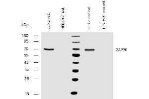 Western blotting analysis of human ZAP70 using mouse monoclonal antibody ZAP-03 on lysates of Jurkat cell line and HEK-293T cell line (negative control) under reducing and non-reducing conditions.