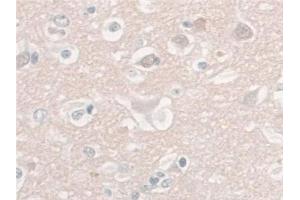 Detection of NSE in Human Cerebrum Tissue using Monoclonal Antibody to Enolase, Neuron Specific (NSE)