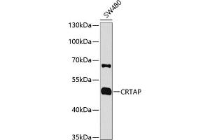 Western blot analysis of extracts of SW480 cells, using CRTAP antibody (ABIN1679366, ABIN3018913, ABIN3018914 and ABIN6220627) at 1:1000 dilution. (CRTAP anticorps  (AA 20-240))