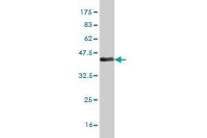 Western Blot detection against Immunogen (37 KDa) . (MEF2A anticorps  (AA 71-170))