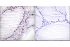 Immunohistochemistry analysis of paraffin-embedded human thyroid gland, using Fos (Phospho-Ser362) Antibody.