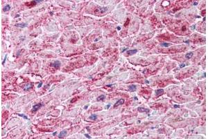Human Heart (formalin-fixed, paraffin-embedded) stained with IKBKB antibody ABIN297183 at 2. (IKBKB anticorps  (AA 310-376))