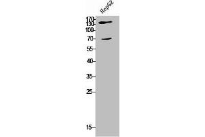 Western Blot analysis of HepG2 cells using COL5A2 Polyclonal Antibody