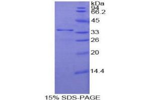SDS-PAGE analysis of Human Nucleoporin 205 kDa Protein. (NUP205 Protéine)